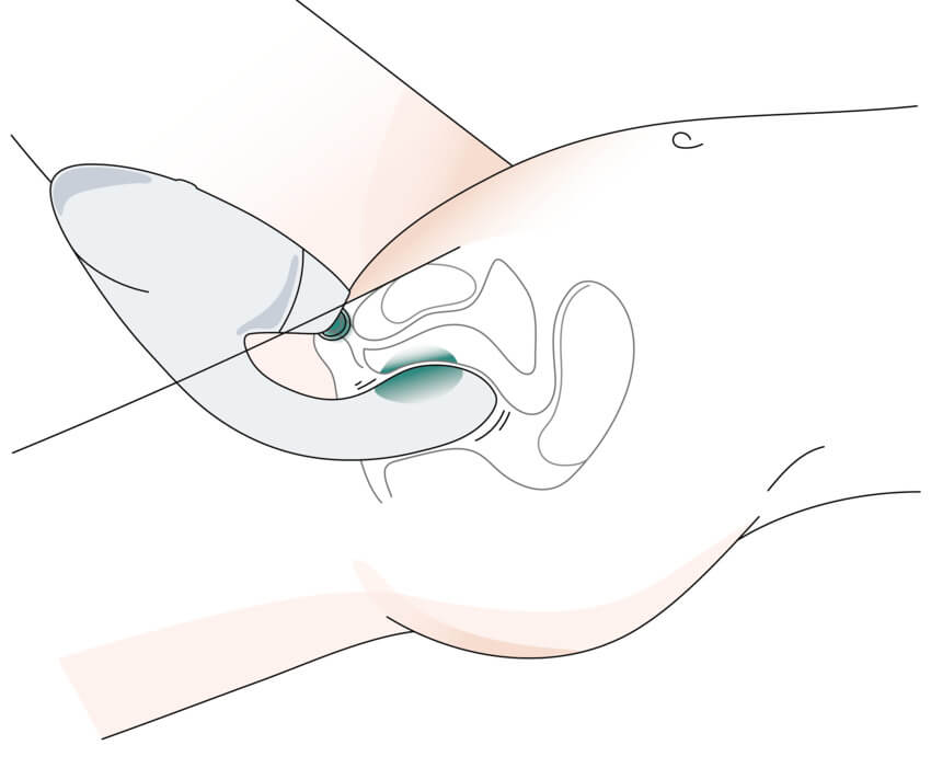Illustrated, cross-section of a g-spot owning person using the Womanizer Duo 2. This angle showcases how the vibrator simultaneously provides air suction to the clitoris while hitting the g-spot with vibrations internally. | Kinkly Shop