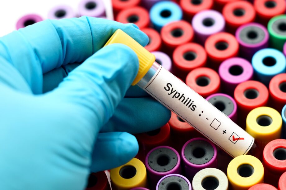 STI Testing: A Breakdown of Tests You Can Take at Home