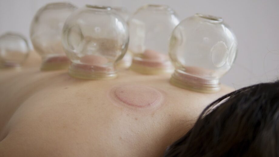 Erotic Cupping: The Kinky Art of Fire and Glass